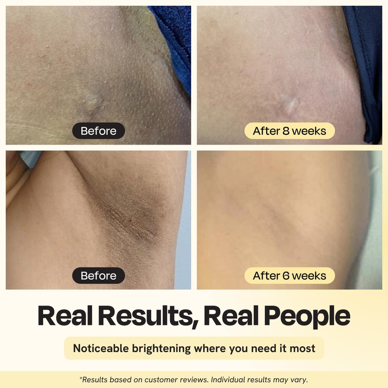 Gleamin Illuminating Intimate Serum with Vitamin C, 4% Niacinamide &