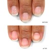 LONDONTOWN kur Nail Probiotic Instant Boost, Nail Mask For Weak/Thin Nails, Clear (25112)