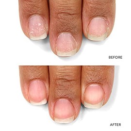 LONDONTOWN kur Nail Probiotic Instant Boost, Nail Mask For Weak/Thin Nails, Clear (25112)