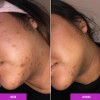 Good Molecules Discoloration Correcting Antimanchas 30 Ml