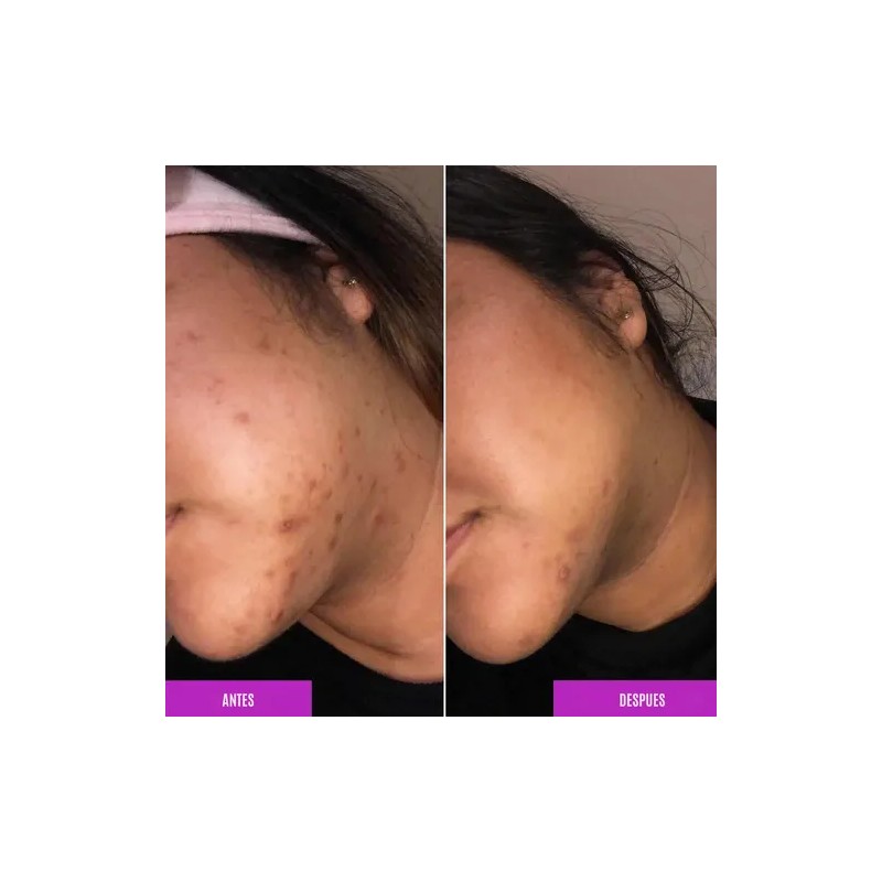 Good Molecules Discoloration Correcting Antimanchas 30 Ml