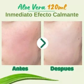 I'm from Rice Toner 150ml Hidrata, Ilumina y Equilibra para Piel Seca y con Tono Irregular