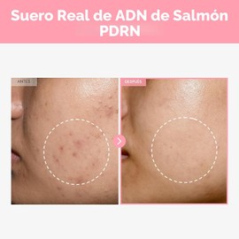 TOSOWOONG Suero Pink Peptide 12 PDRN con ADN de salmón PDRN, 33 ml/1.11 oz, 10320 ppm, 12 péptidos, niacinamida, brillo para la piel, hidratante, humectante, tono de piel desigual, cuidado coreano
