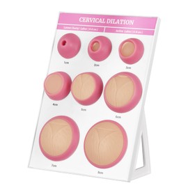 Cervical Dilation Simulator with 1-8cm, Chart on Display Board for Midwife and Doula Training, Medical Education, and Birth Learning