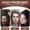 HQRKOTM Pack of 2 Dandruff Comb for Clean Scalp, Refreshing