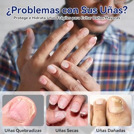 Parches para Uñas 32 Pieces, Parches para Uñas de los Pies Protectoras, Nail Patches Compacto y Portátil, Comodidad Invisible(1 paquete)