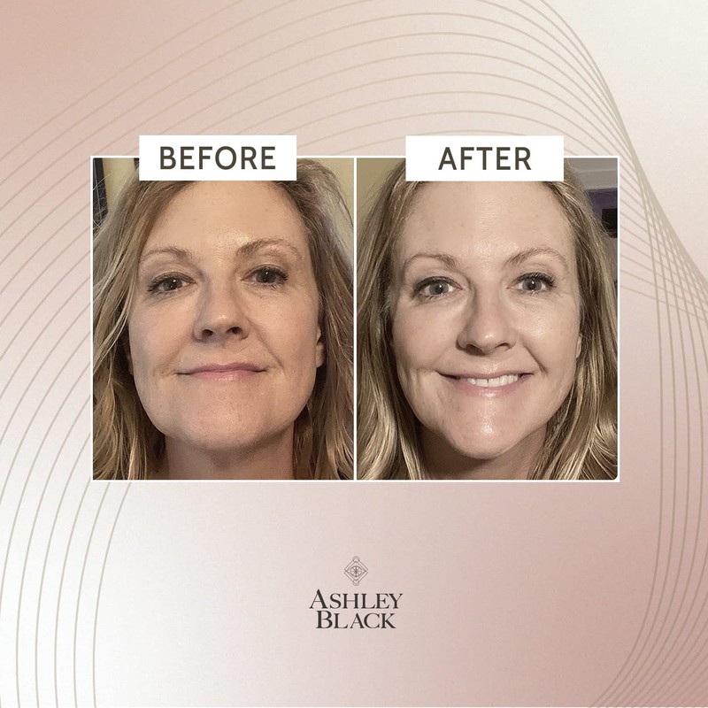 Extreme Tightening Serum by Ashley Black. Instant Skin Tightening Effect