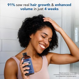 Botanic Hearth Aceite De Romero Puro Para El Crecimiento Del Cabello Infundido Con Biotina Tratamiento Fortalecedor Del Cabello Nutritivo Y Voluminizador Con Aceite De Jojoba Y Aceite De Ricino
