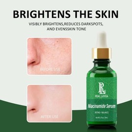 100% Organische Niacinamide Serum mit Vitamin B3 Gesichtsserum mit Organische Aloe, Avocadoöl, Hyaluronsäure, Rosmarin & Vitamin E | Anti-Aging & Anti-Falten für alle Hauttypen-30ml