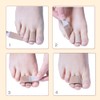 Broken Toe Splint, Hammer Toe Splint Bandage, Broken Toe Bandages,