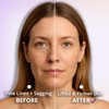 5-in-1 Microcurrent Facial Device for Face Tightening, Lifting & Wrinkle