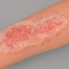 MedEduQuest Abrasion Wound Care Training Sleeve, Wound Packing Trainer for