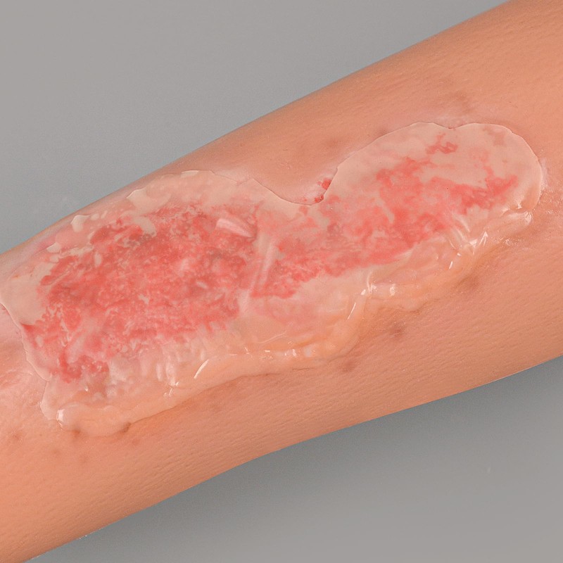 MedEduQuest Abrasion Wound Care Training Sleeve, Wound Packing Trainer for