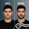 Dermaroller Barba Rodillo Dermafol 0.5mm Titanio Con Estuche