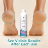 Lee Beauty 8oz Professional Gel Callus Remover for Feet -