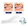 Best Versión Mejorada 3d Blanqueamiento Dental Pegatinas 14 Pares