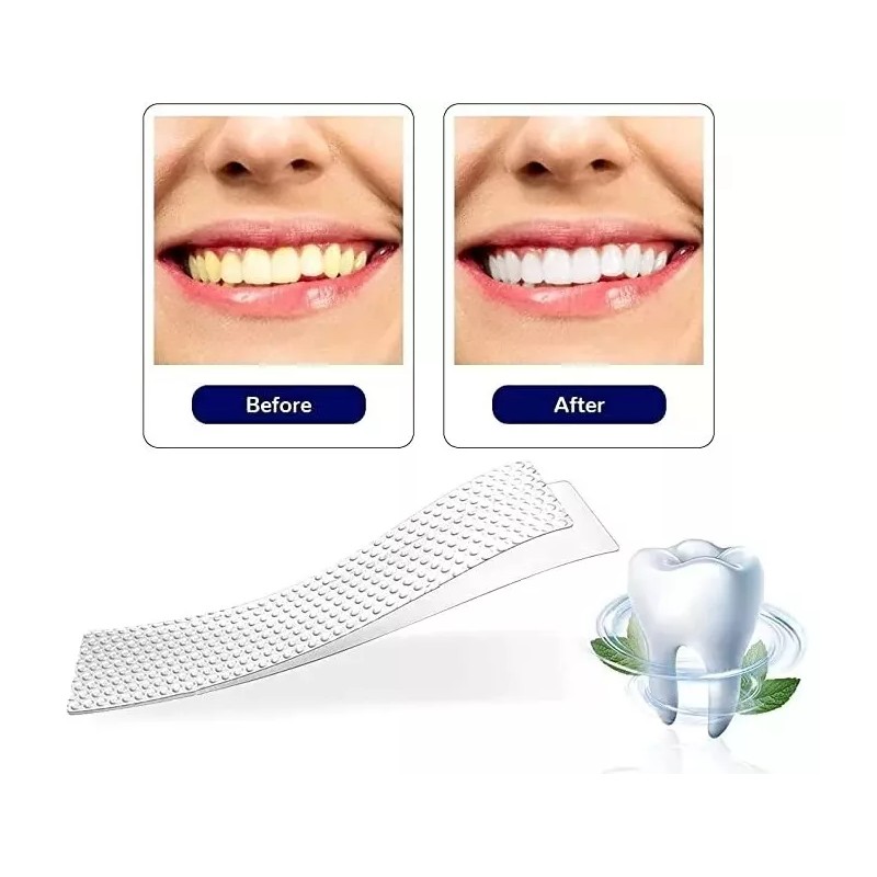 Best Versión Mejorada 3d Blanqueamiento Dental Pegatinas 14 Pares