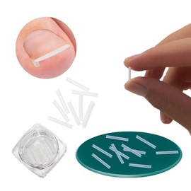 Nail care problem toenail self-care U-shaped curve stick 50p - Toenail care curve stick 50p / 네일케어 문제성 발톱 셀프 관리 U자형 커브스틱 50p - 발톱관리커브스틱 50p