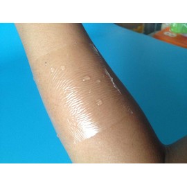 Flexifix Opsite Transparent Waterproof Film Roll 10cm x 1m