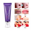 Universo en Linea Crema Aclaradora Zona Intima Pezón Manchas Codos