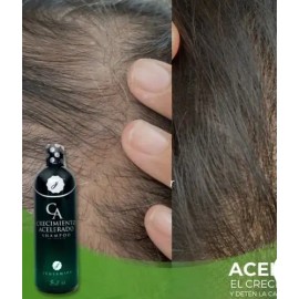 3 Shampoo Crecimiento Acelerado Jehesmipa                                                                                                             