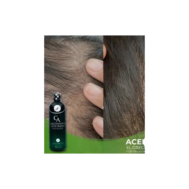 3 Shampoo Crecimiento Acelerado Jehesmipa