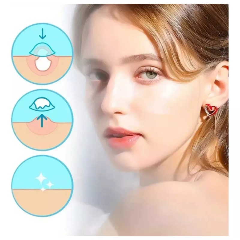 Veraly 72 Parches Invisibles Eliminar Acne Espinillas Granos Poro
