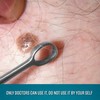 DEXSUR Fox Dermal Curette 1 mm Round Dermatology Scrape Instruments