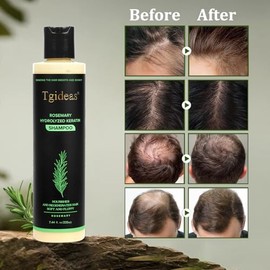 Champú orgánico para el crecimiento del cabello con romero para mujeres y hombres Champú natural para fortalecer y espesar con queratina hidrolizada p