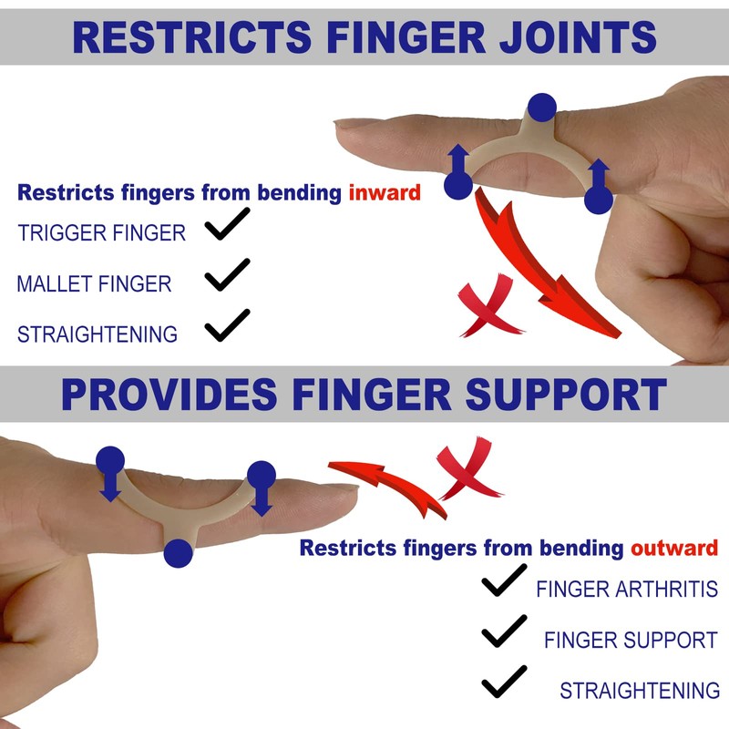 RonJea 6Pcs Oval Finger Splints, Trigger Finger Splint for Trigger/Mallet/Arthritis/Straightening,