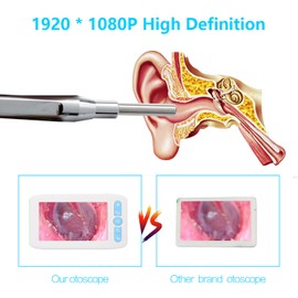 Digital Otoscope with 6 LEDs Lights 32G TFcard 3.9mmm 1080P High Definition Ear Scope Camera 4.3in IPS Screen Earwax Removal Tool and Specula for Adults and Kids