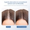 Hair Growth Serum for Thinning Hair | Strengthens & Thickens