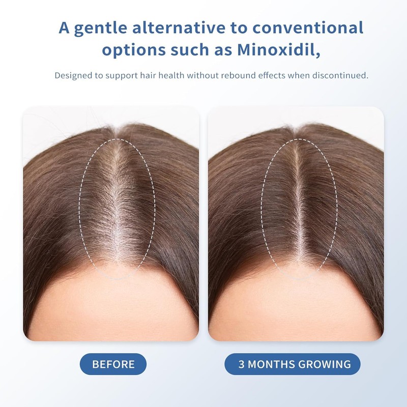 Hair Growth Serum for Thinning Hair | Strengthens & Thickens