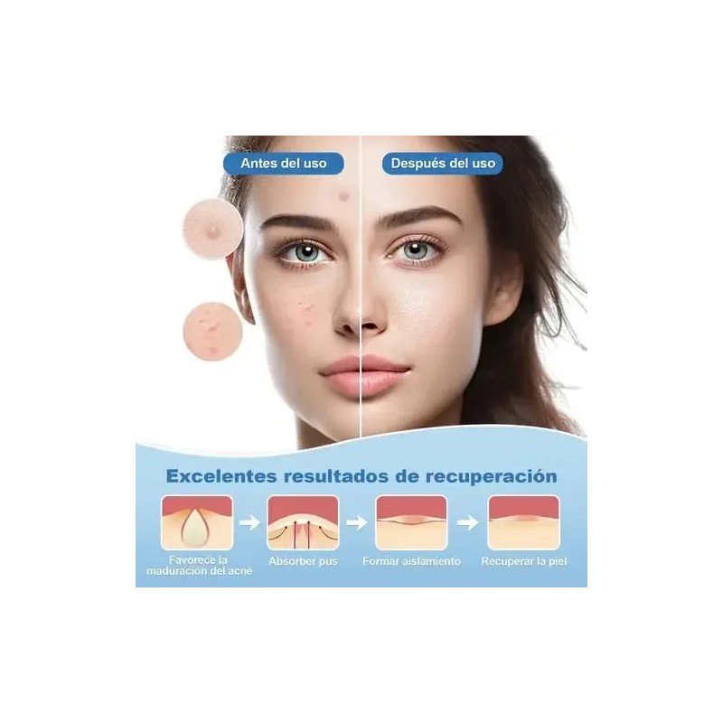 144 Parche Adhesivos Para Imperfecciones Piel Acné Verrugas