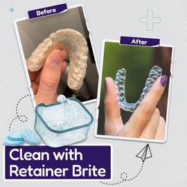 Retainer Brite Cleaning Kit Including 96 Tablets (3 Month Supply) and Case - Retainer Box Ideal for retainers, mouthguard, dentures, invisalign. Removes Plaque and Tartar. (Blue)
