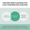 SKIN1004 [SKIN1004]Madagascar Centella Tea-Trica Bha Foam 125ml