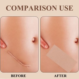 Tattoo Cover Up Patch, 10 Pcs Tattoo Cover Up Waterproof, Ultra Thin Sweatproof Cover-up Tape For Ta-ttoo Scar And Birthmarks Cuttable Ta-ttoo Cover Tape For Light To Medium Skin Tone