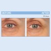 Serious Skincare- - Eyetality Pm Total Eye Care - Night