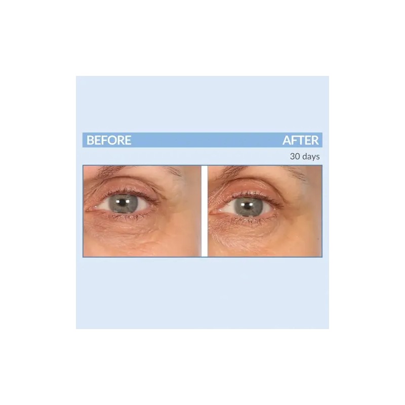 Serious Skincare- - Eyetality Pm Total Eye Care - Night