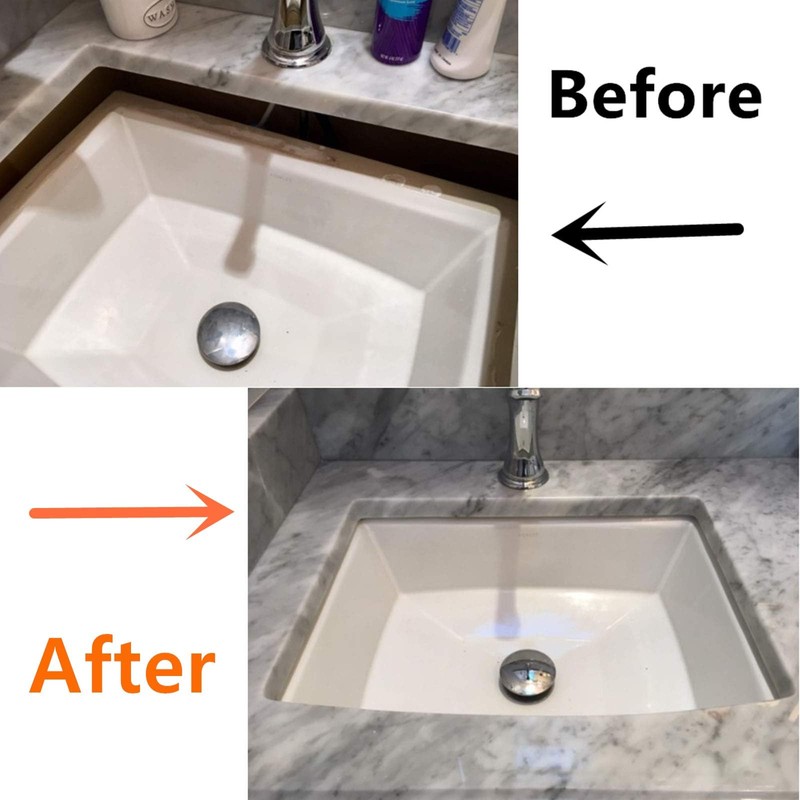 Undermount Sink Brackets,Undermount Sink Repair kit, Best undermount Sink Support,Undermount