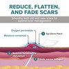 Epi-Derm Patch – Professional-Grade Silicone Scar Sheets for Small Keloid