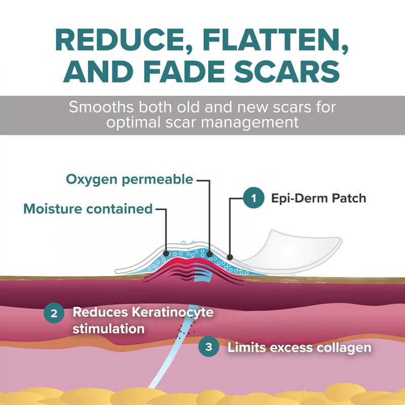 Epi-Derm Patch – Professional-Grade Silicone Scar Sheets for Small Keloid