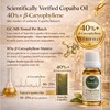 Nativilis Copaiba Balsam Essential Oil (10ml) - 100% Natural (Copaifera