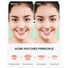 ZATKTK Acne Pimple Patch (180 Counts 4 Sizes), FSA Eligible