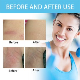 Anti Chafe Stick,Waterproof Glide Anti Chafe Balm,Anti-Friction Stick of Thigh,Anti Chafe Gel for Women,Anti-Chafing Stick,Anti Chafing Cream,Running Chafe Stick for Heel,Smooth and Protect Skin