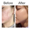 The INKEY List 10% Niacinamide Serum 30ml