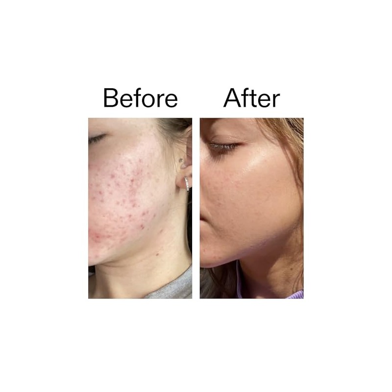 The INKEY List 10% Niacinamide Serum 30ml