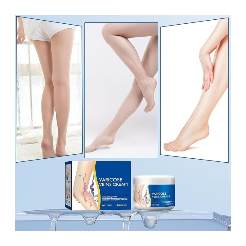 Lmuwecno Varicose Veins Cream(1PCS)