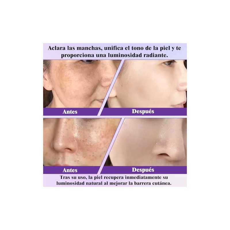 Crema Epiglow Melanex Advanced Anti-Hiperpigmentación