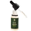 Acne Serum (0.7 fl oz)